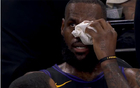 郭艾倫眼傷受矚目！NBA名將眼傷回顧，詹皇科比哈登等遭插眼