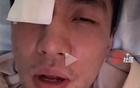 郭艾倫眼傷曝光，臺灣球員已道歉，專家警告可能失明。