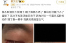 "郭艾倫談傷情，首反應視受損"